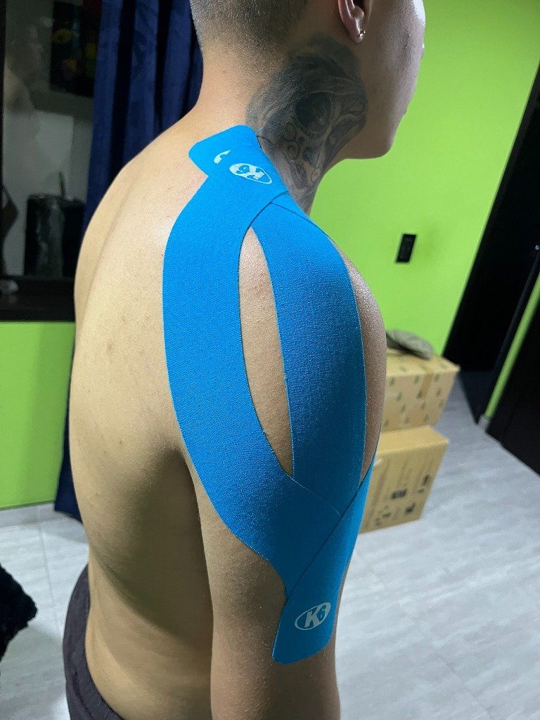 Terapia física de recuperación muscular en Bogotá